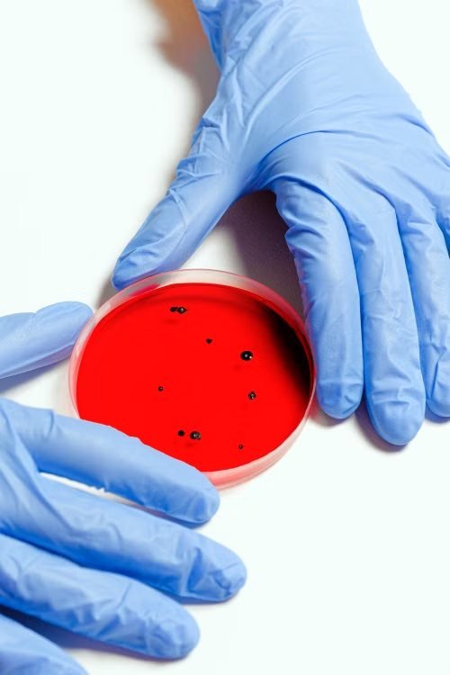 Two gloved hands steadying a petri dish of red agar marked with a small number of dark colonies